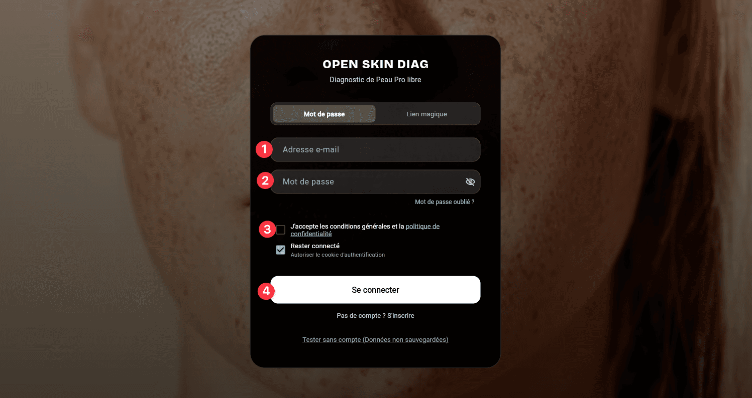 Écran de connexion OpenSkinDiag en mode mot de passe : 1 adresse e-mail, 2 mot de passe, 3 case d'acceptation des conditions générales, 4 bouton Se connecter